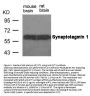 Anti-Synaptotagmin 1 (Ab-309) SYT1 Antibody