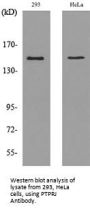 Anti-PTPRJ/Dep1 Antibody