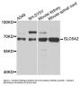 Anti-SLC6A2 Antibody