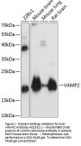 Anti-VAMP2 Antibody