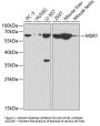 Anti-MSR1 Antibody