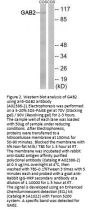 Anti-GAB2 (Ab-159) Antibody