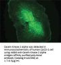 Anti-CK2a CSNK2A1 Antibody