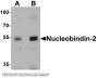 Anti-Nucleobindin-2 NUCB2 Antibody