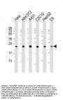 Anti-RAB7 Antibody (C-term)