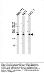 Anti-RAB7 Antibody (C-term)