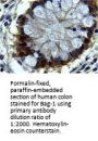 Anti-Bag-1 Antibody