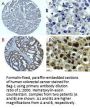 Anti-Bag-1 Antibody