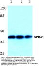 Anti-GPR41 FFAR3 Antibody