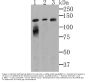 Anti-Lipin 1 LPIN1 Antibody