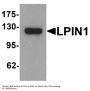Anti-LPIN1 Antibody