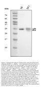 Anti-NTAL/LAT2 Antibody Picoband®
