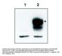 Anti-TrkCT1 NTRK3 Antibody
