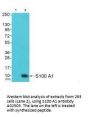 Anti-S100 A1 Antibody