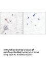 Anti-S100 A1 Antibody