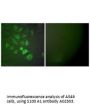 Anti-S100 A1 Antibody