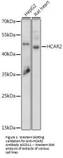 Anti-HCAR2 Antibody