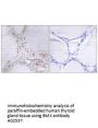 Anti-BMX Antibody