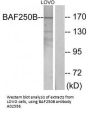 Anti-BAF250B ARID1B Antibody