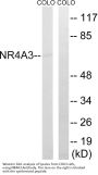 Anti-NR4A3/Nor1 Antibody