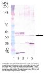 Anti-CaMKII Camk2d Antibody