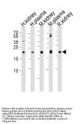 Anti-GPX3 Antibody (Center)