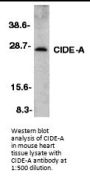 Anti-CIDE-A Antibody