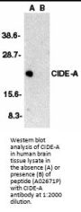 Anti-CIDE-A Antibody