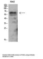 Anti-AMPK gamma2 PRKAG2 Antibody