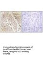 Anti-PRKAG2 Antibody