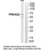 Anti-PRKAG2 Antibody