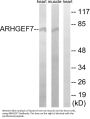 Anti-ARHGEF7/Beta Pix Antibody