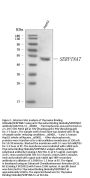 Anti-Thyroxine Binding Globulin/SERPINA7 Antibody Picoband®