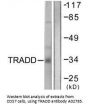 Anti-TRADD Antibody