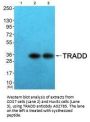 Anti-TRADD Antibody