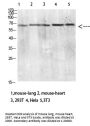 Anti-CD299 CLEC4M Antibody