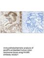 Anti-PIK3R5/Pi 3 Kinase P101 Antibody