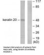 Anti-Keratin 20 KRT20 Antibody