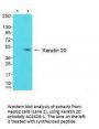 Anti-Keratin 20 KRT20 Antibody
