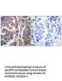 Anti-Keratin 20 KRT20 Antibody