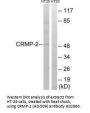Anti-CRMP-2 (Ab-509) DPYSL2 Antibody