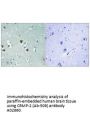 Anti-CRMP-2 (Ab-509) DPYSL2 Antibody