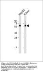 Anti-CES2 Antibody (Center)