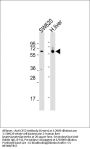 Anti-CES2 Antibody (Center)
