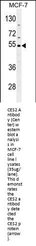 Anti-CES2 Antibody (Center)