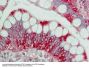 Anti-TRK Fused gene TFG Antibody