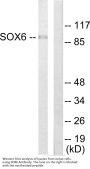 Anti-Transcription factor SOX-6 SOX6 Antibody