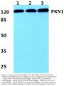 Anti-PKN1 Antibody