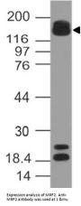 Anti-MRF2 ARID5B Antibody