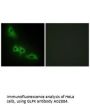 Anti-GLPK GK Antibody